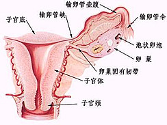 附件炎