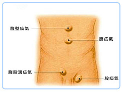 疝气