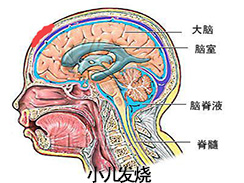 小儿高热图集