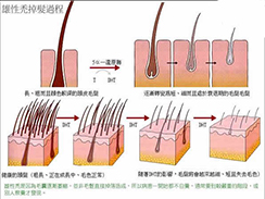 脱发