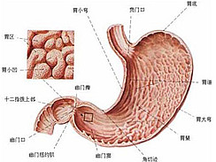 急性胃炎