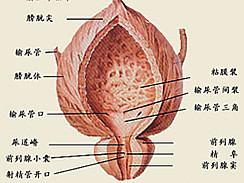 膀胱癌