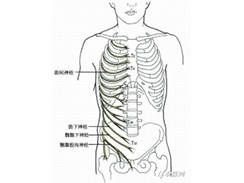 肋间神经痛