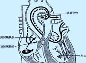 肺血流量很少