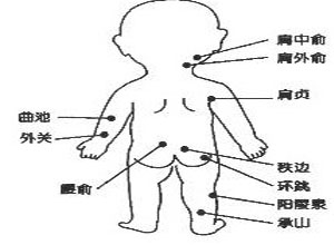 股前外侧麻木、蚁行感