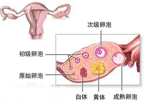 黄体破裂