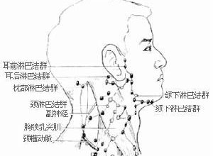 颈部淋巴结肿大