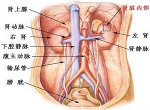 巨输尿管症