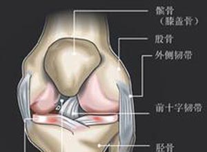 髌骨劳损