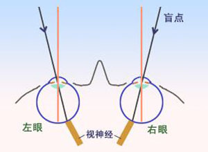 盲点