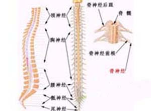 躯体化障碍