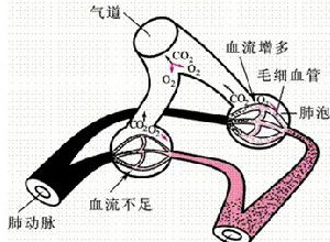 全身衰竭