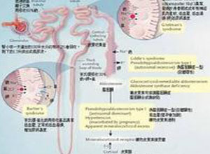 醛固酮分泌增多