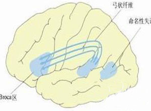 认知功能损害