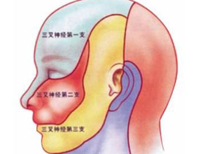 闪电样痛