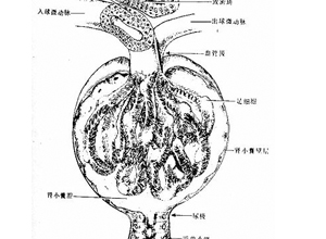 肾小球旁器增生