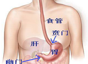 食物在胃的通过障碍