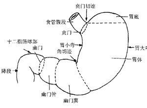 胃区包块