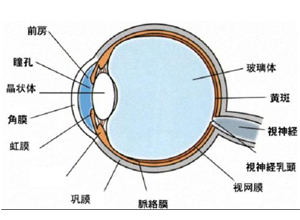 先天性虹膜缺乏