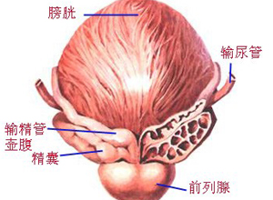 腺性或囊性膀胱炎