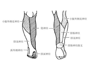 小腿内侧感觉丧失