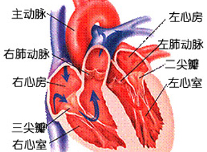 心肌坏死广泛