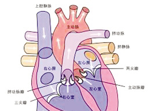 心脏杂音