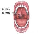 新生儿绿牙或棕褐色牙