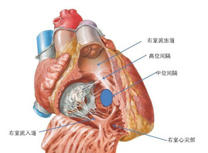 血流动力学障碍