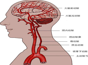 大动脉供血障碍