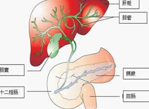 胆囊积水