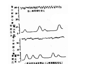 正弦胎心率