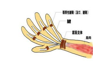 指、拇、脘的伸展功能完全丧失