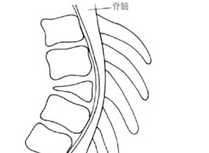 椎节分裂